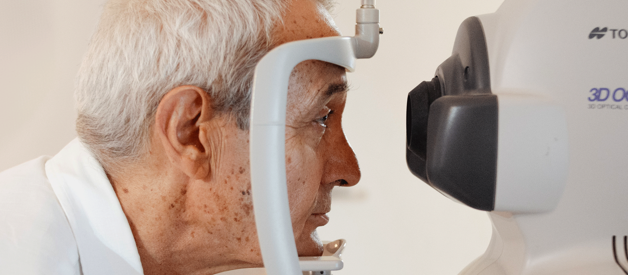 Plástica de párpados